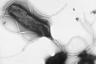 Electron micrograph of bacterium H. pylori, with flagella clearly visible. Image by Yutaka Tsutsumi.